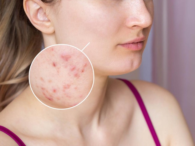 Ilustrasi wanita memakai skincare