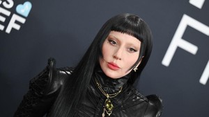 Gaga juga punya riwayat masalah kesehatan dan cedera yang sempat membuatnya harus menghadapi berbagai tantangan fisik. Foto: Gilbert Flores/Billboard via Getty Images