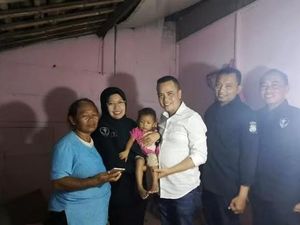 Polda DIY Bantu Pengangkatan Tumor Balita Ningsih