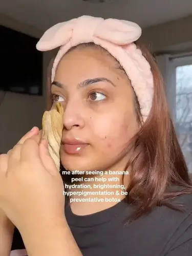 Tren viral perawatan kulit pakai kulit pisang.