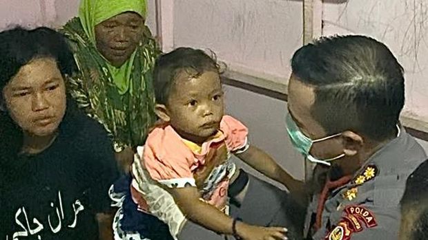 Ningsih, balita penderita tumor dirawat di RS Bhayangkara Polda DIY