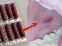 Dikira Permen, Wanita Ini Lahap Petasan dan Meledak di Mulutnya!