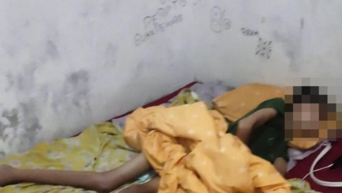 Korban pengeroyokan hingga lumpuh di Rejang Lebong harapkan bantuan.