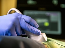 Ngerinya Kanker Organ Pencernaan yang Ancam Generasi X-Milenial