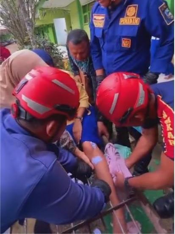 Kaki siswi di Pacitan terjepit besi penutup selokan.