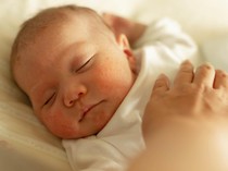 Waspada Jika Balita Anda Tidur Mendengkur, Ini Kata IDAI