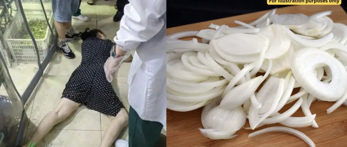 Kepleset Bawang Bombai, Wanita Ini Minta Ganti Rugi Rp 448 Juta!