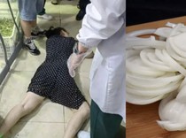 Kepleset Bawang Bombai, Wanita Ini Minta Ganti Rugi Rp 448 Juta!