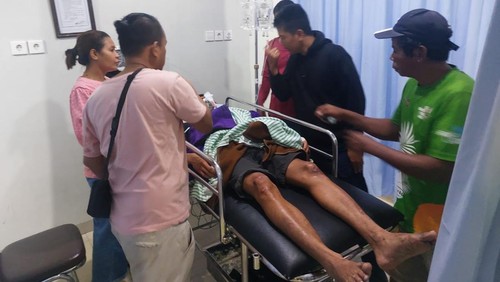 Yohanis Ngongu Bongu dirawat di rumah sakit seusai dibacok penghuni kos di depan sebuah kafe di Jalan Bypass Ngurah Rai, Nusa Dua, Kelurahan Benoa, Kuta Selatan, Badung, Bali. (Foto: Dok. Polsek Kuta Selatan)