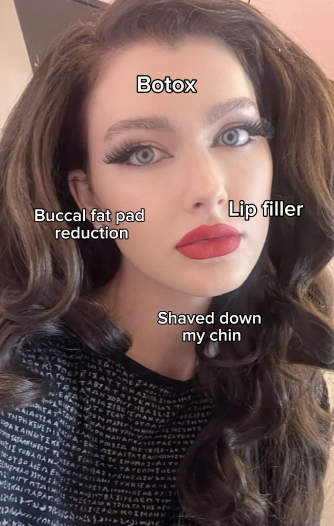 Menurut Rachel, suaminya lah yang memperkenalkan operasi plastik kepadanya. Benjor sebenarnya adalah orang yang menginspirasi saya untuk menerima operasi plastik, ujar Rachel dalam sebuah wawancara di kanal YouTube Love Don’t Judge. Foto: dok. Instagram @itsbenjor