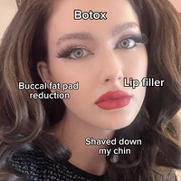 Menurut Rachel, suaminya lah yang memperkenalkan operasi plastik kepadanya. Benjor sebenarnya adalah orang yang menginspirasi saya untuk menerima operasi plastik, ujar Rachel dalam sebuah wawancara di kanal YouTube Love Don’t Judge. Foto: dok. Instagram @itsbenjor