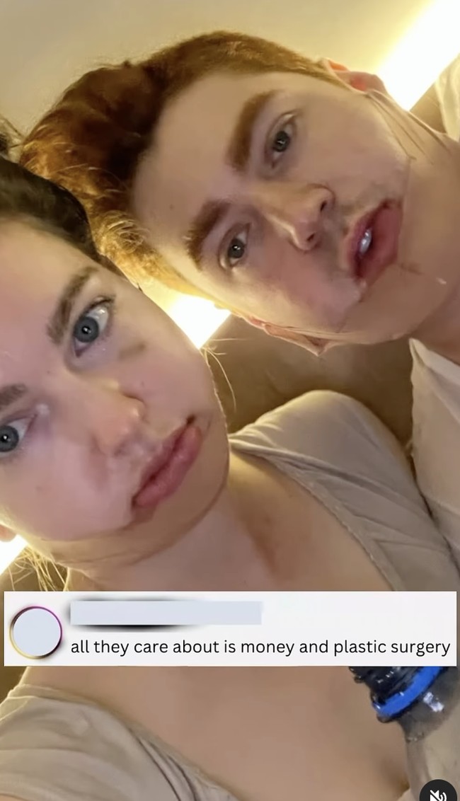 Dengan perubahan wajah mereka, kehidupan sosial keduanya pun jadi sorotan, yang tidak jarang mendapatkan hujatan.  Foto: dok. Instagram @itsbenjor