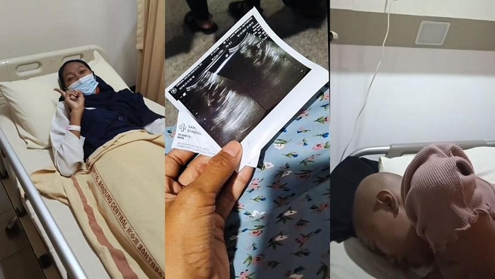 Wanita di Purwakarta kena kanker serviks
