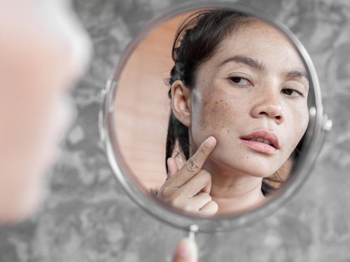 Rekomendasi 7 Skincare untuk Menghilangkan Flek Hitam di Usia 40 Tahun