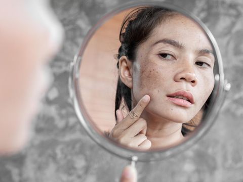 Ilustrasi Bahaya Skincare Mengandung Merkuri