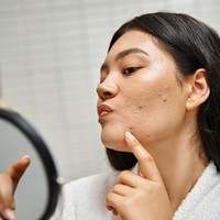 7 Ciri-Ciri Skincare Mengandung Merkuri yang Perlu Dihindari