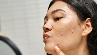 7 Ciri-Ciri Skincare Mengandung Merkuri yang Perlu Dihindari