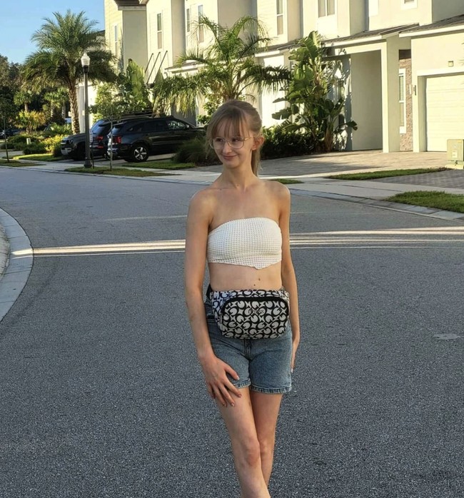 Akibat pengobatan yang dijalaninya—termasuk operasi, kemoterapi, dan radioterapi—pertumbuhannya terhenti, dan ia hanya mencapai tinggi sekitar 147 cm. Foto: Instagram