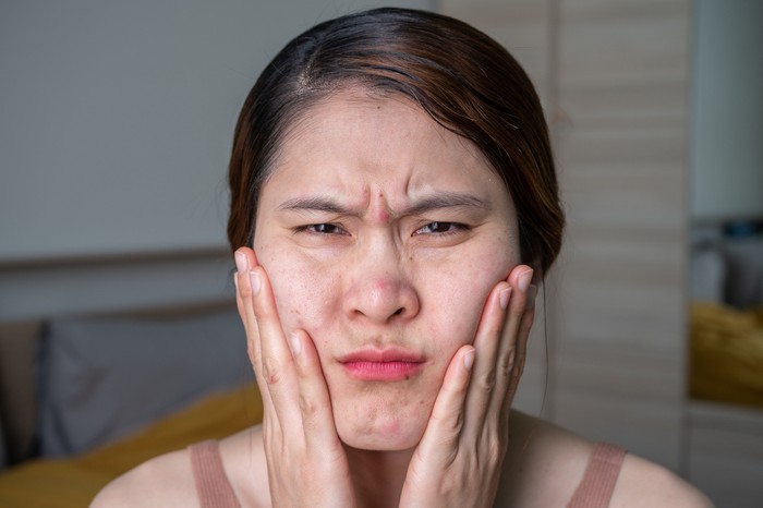 Perbedaan Bruntusan dan Jerawat