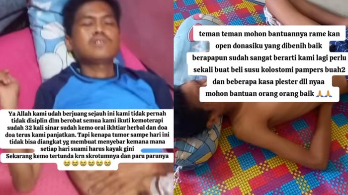 Hati-hati! Dokter Ungkap Gejala Kanker Rektum yang Bisa Terlihat di Feses