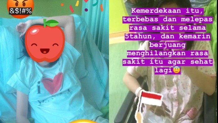 Kebiasaan yang Picu Wanita Jaksel Harus Diangkat Kantong Empedunya di Usia 22