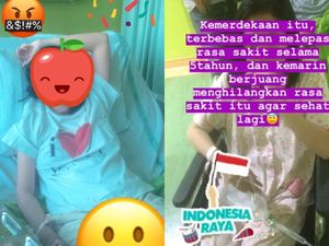 Pengakuan Wanita Jaksel Hidup Tanpa Kantong Empedu, Ini yang Dirasakan