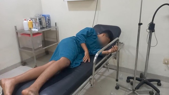 Andre (15) diduga jadi korban peluru nyasar, menembus dari pinggang hingga paha.