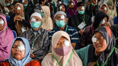 Layanan Operasi Katarak Gratis dari Kemensos di Bandung Raya