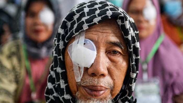 Sejumlah lansia duduk di ruangan setelah menjalani operasi katarak di RSAU dr M Salamun di Bandung, Jawa Barat, Jumat (7/3/2025). Kementerian Sosial bekerja sama dengan RS AU Salamun menyelenggarakan layanan operasi katarak gratis kepada 275 lansia yang ada di Bandung Raya dan sejak tahun 2022 hingga awal Maret 2025 Kemensos telah memberikan layanan operasi katarak gratis kepada 11.319 jiwa yang tersebar di seluruh Indonesia. ANTARA FOTO/Raisan Al Farisi/tom.