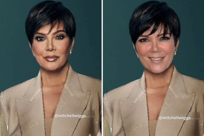 Dilansir DailyMail, ahli bedah plastik Dr Douglas Steinbrech mengatakan ia meyakini mereka semua telah menjalani perawatan ekstensif. Bukan hanya para saudari tapi juga ibu mereka Kris Jenner yang tampak awet muda di usia 69 tahun.Foto: Dok. TikTok @mitchellwiggs