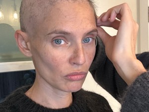 Kisah Model Sakit Kanker Ditolak Tampil di Victorias Secret Fashion Show