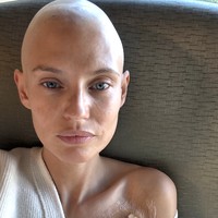 Bianca Balti, supermodel asal Italia yang dikenal lewat berbagai pemotretan ikonik untuk majalah Sports Illustrated, kini mencuri perhatian dunia dengan penampilan barunya. Bianca yang selama ini berjuang dengan kanker ovarium stadium 3C kini tampil botak. Foto: dok. Instagram @biancabalti