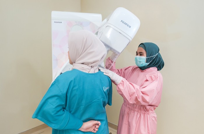 70% Kasus Kanker Payudara Terdeteksi pada Stadium Lanjut