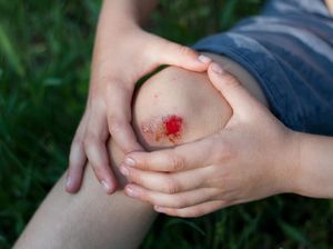 Luka di Tubuh Manusia Sembuh Lebih Lambat Dibanding Hewan, Ini Alasannya