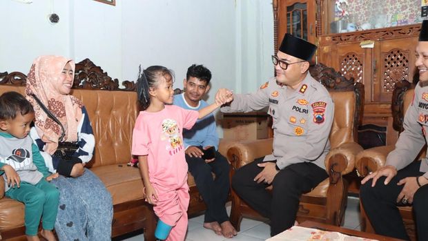 Polres Kebumen berikan bantuan kaki palsu kepada seorang anak di Desa Adikarso, Kecamatan Kebumen, Kabupaten Kebumen, Minggu (9/3/2025).