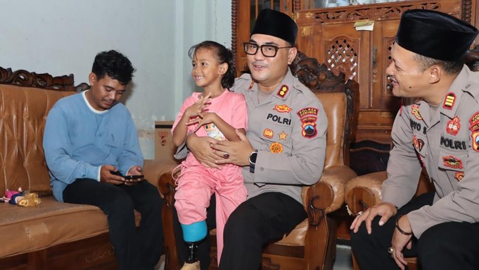Polres Kebumen berikan bantuan kaki palsu kepada seorang anak di Desa Adikarso, Kecamatan Kebumen, Kabupaten Kebumen, Minggu (9/3/2025).