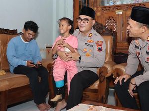 Senyum Syahira Dapat Hadiah Kaki Palsu dari Kapolres Kebumen
