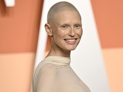 Supermodel Bianca Balti Botak Pasca-Kemoterapi, Lebih PD di Karpet Merah