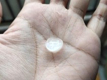 Fenomena Hujan Es Melanda Sleman