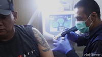 Petugas melakukan proses penghapusan tato menggunakan laser.