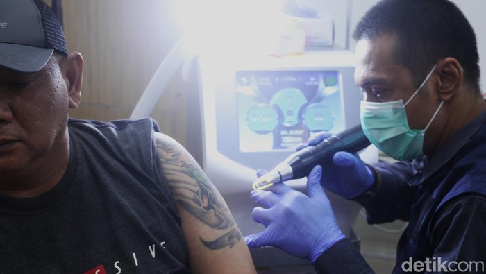 Layanan Gratis Hapus Tatto Saat Ramadan Petugas melakukan proses penghapusan tatto menggunakan laser di Balai Kota, Jakarta, Selasa (11/03/2025). BAZNAS Jakarta menggelar program layanan hapus tatto Ramadan bagi masyarakat dengan target menjangkau 700 peserta yang tersebar di wilayah Jakarta.