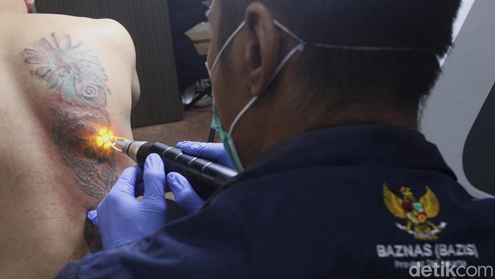 Petugas melakukan proses penghapusan tatto menggunakan laser di Balai Kota, Jakarta, Selasa (11/03/2025). BAZNAS Jakarta menggelar program layanan hapus tatto Ramadan bagi masyarakat dengan target menjangkau 700 peserta yang tersebar di wilayah Jakarta.