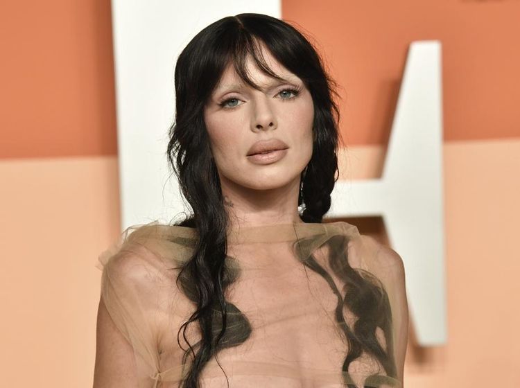 Penampilan Julia Fox Nyesal Operasi Plastik, Mau Balik Kayak Dulu