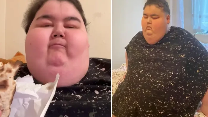 TikToker Mukbang Meninggal Dunia di Umur 24, Alami Komplikasi Akibat Obesitas