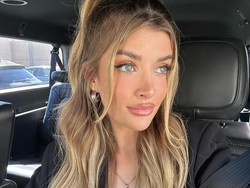 Kontroversi Putri Charlie Sheen, Baru Usia 21 Sudah Oplas Payudara dan Hidung