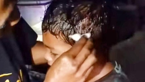 Ahmad Mulki, bocah berusia delapan tahun asal Dusun Jurang Koak, Desa Bebidas, Kecamatan Wanasaba, Lombok Timur, NTB, luka di kepalanya akibat perang sarung, Kamis (13/3/2025) malam. (Istimewa)