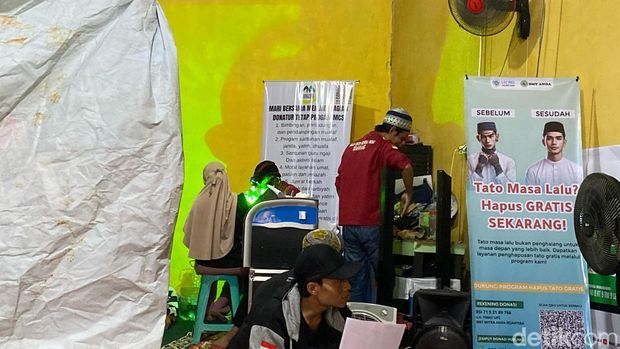 Suasana penghapusan tato gratis di Mualaf Center Semarang, Kecamatan Pedurungan, Kota Semarang, Jumat (14/3/2025).