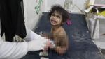 Miris, Anak-anak Jadi Korban Serangan Udara AS di Yaman