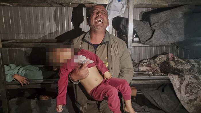 Israel Kembali Gempur Gaza di Tengah Gencatan Senjata, 121 Orang Tewas Injured Palestinians wait for treatment at the hospital following Israeli army airstrikes in Khan Younis, southern Gaza Strip, Tuesday, March 18, 2025. (AP Photo/Mohammad Jahjouh)