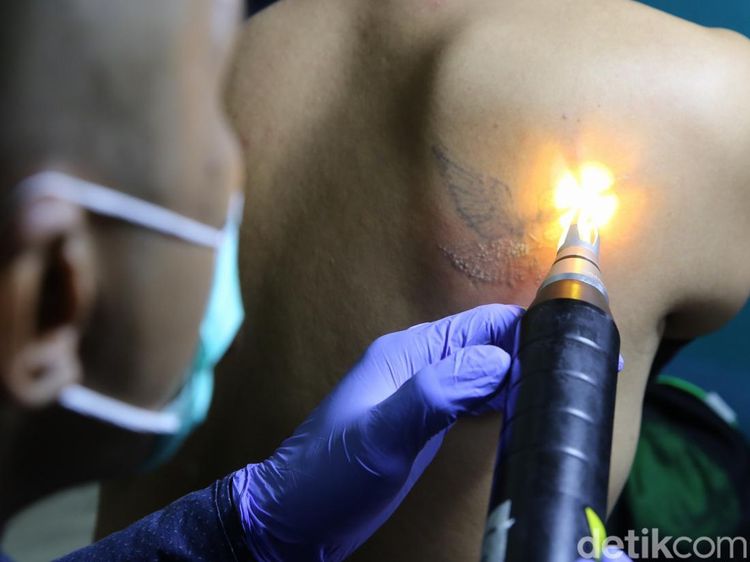 Ratusan Orang Ikut Hapus Tato Gratis di Kantor Walikota Jakarta Timur